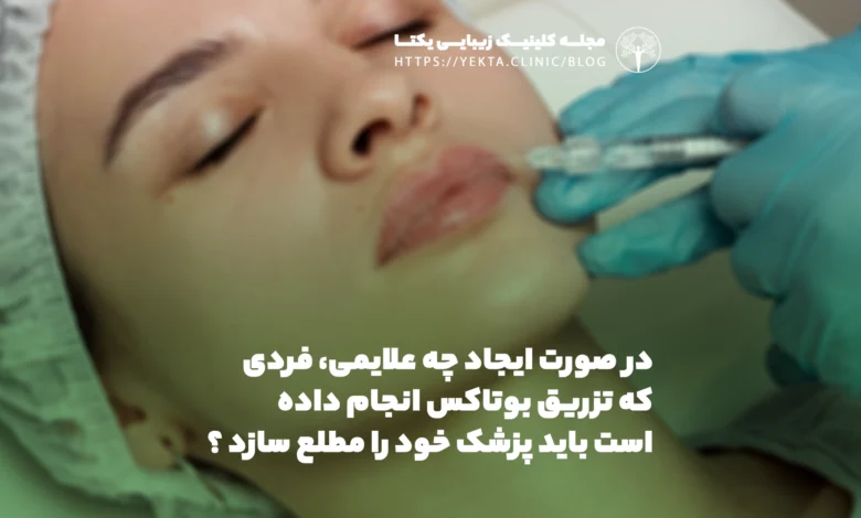 در صورت ایجاد چه علایمی، فردی که تزریق بوتاکس انجام داده است باید پزشک خود را مطلع سازد ؟