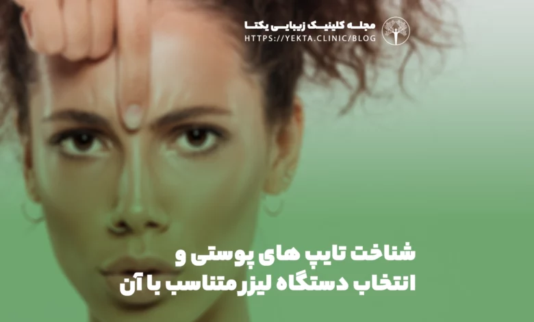 شناخت تایپ های پوستی و انتخاب دستگاه لیزر متناسب با آن