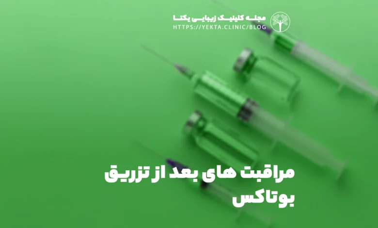 مراقبت های بعد از تزریق بوتاکس