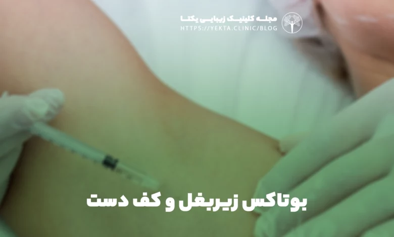 بوتاکس زیربغل و کف دست