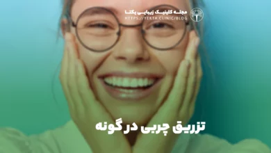 تزریق چربی در گونه