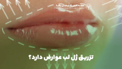 تزریق ژل لب عوارض دارد؟