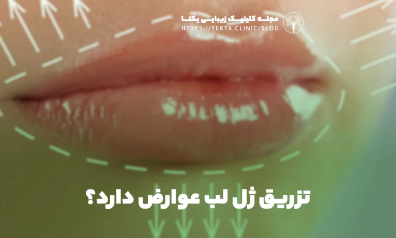 تزریق ژل لب عوارض دارد؟