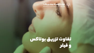 تفاوت تزریق بوتاکس و فیلر