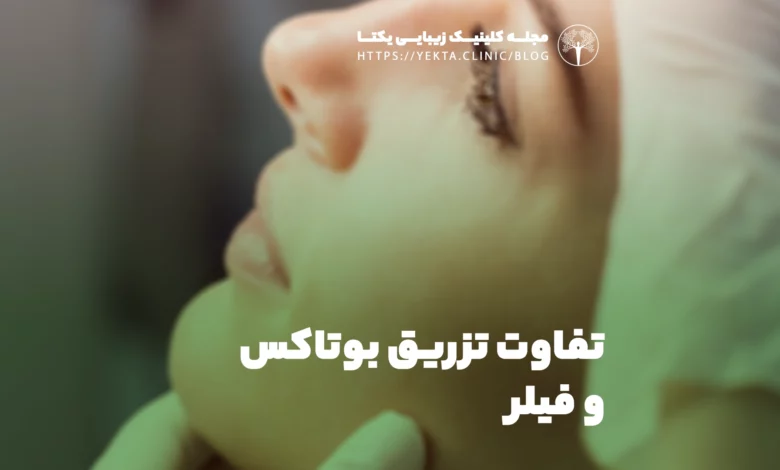 تفاوت تزریق بوتاکس و فیلر