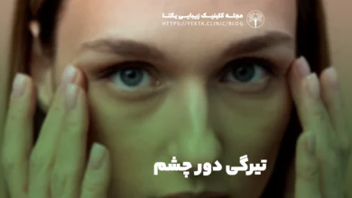 تیرگی دور چشم