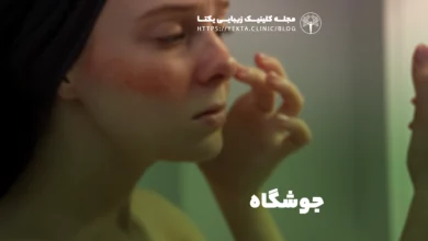 جوشگاه