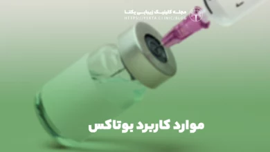 موارد کاربرد بوتاکس