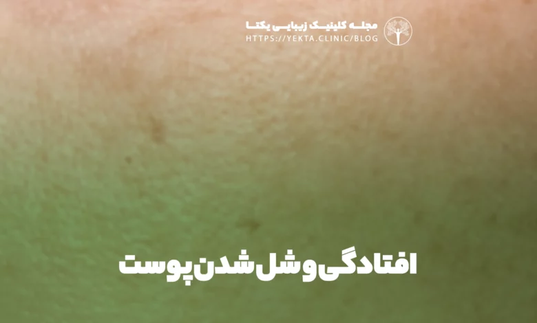 افتادگی و شل شدن پوست
