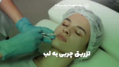 تزریق چربی به لب