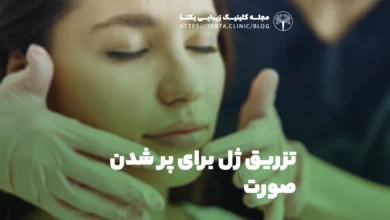 تزریق ژل برای پر شدن صورت