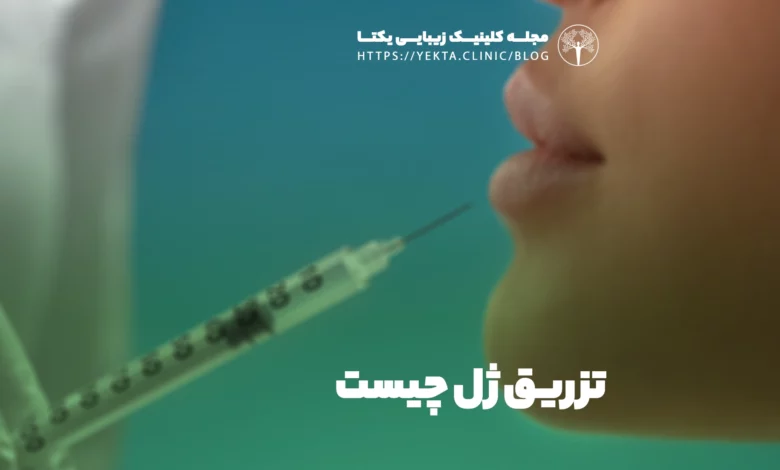 تزریق ژل چیست