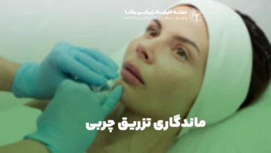 ماندگاری تزریق چربی
