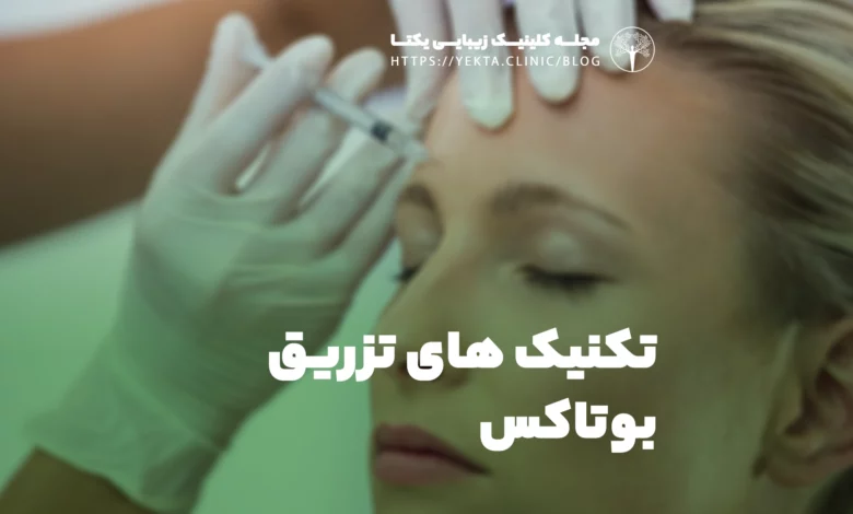 تکنیک های تزریق بوتاکس