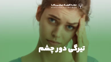 تیرگی دور چشم