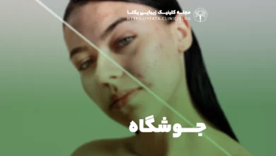 جوشگاه