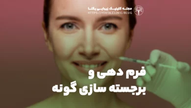 فرم‌دهی و برجسته‌سازی گونه