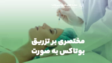 مختصری بر تزریق بوتاکس به صورت