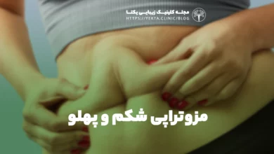 مزوتراپی شکم و پهلو