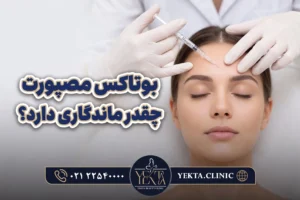 بوتاکس مصپورت چقدر ماندگاری دارد