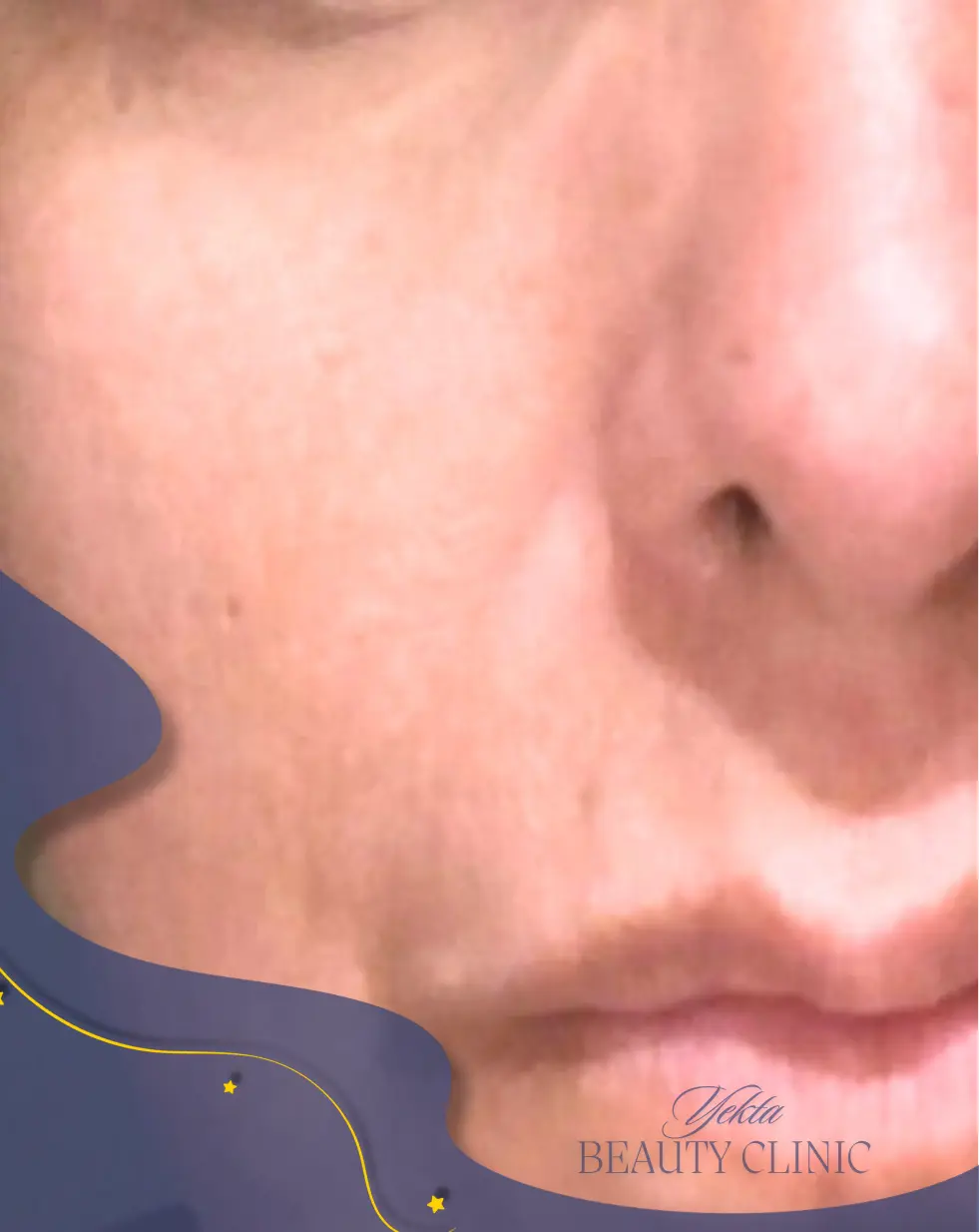 بعد کربوکسی تراپی۲ بعد کربوکسی تراپی2