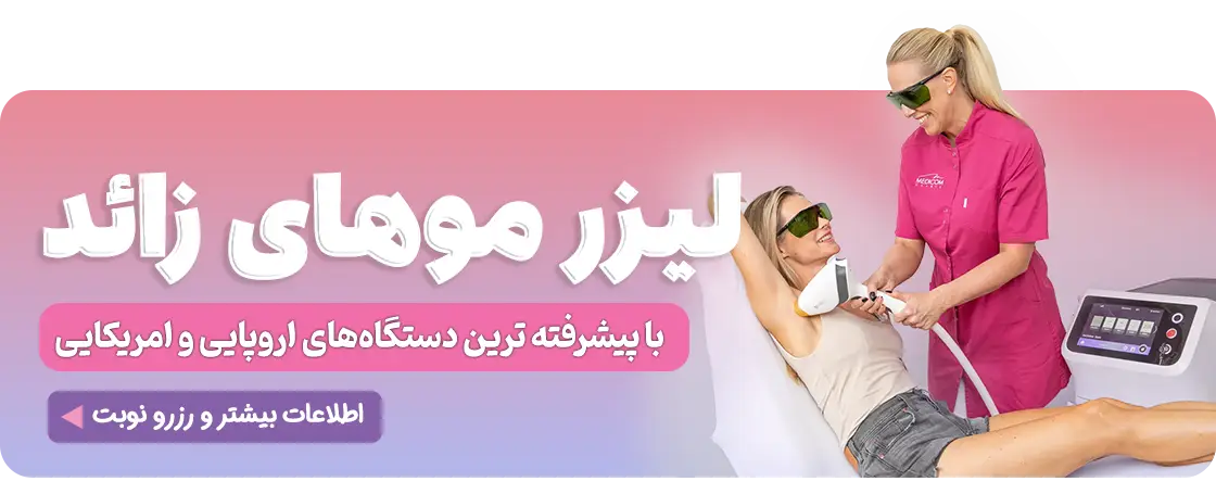 لیزر موهای زائد