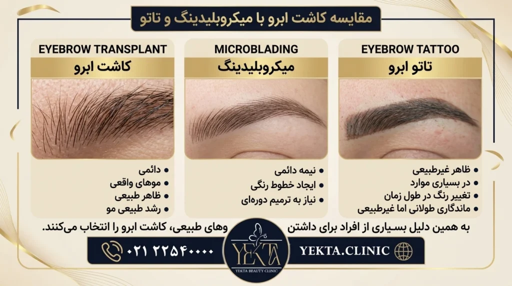 کاشت ابرو، کاشت ابرو پیروزی، کاشت ابرو طبیعی،