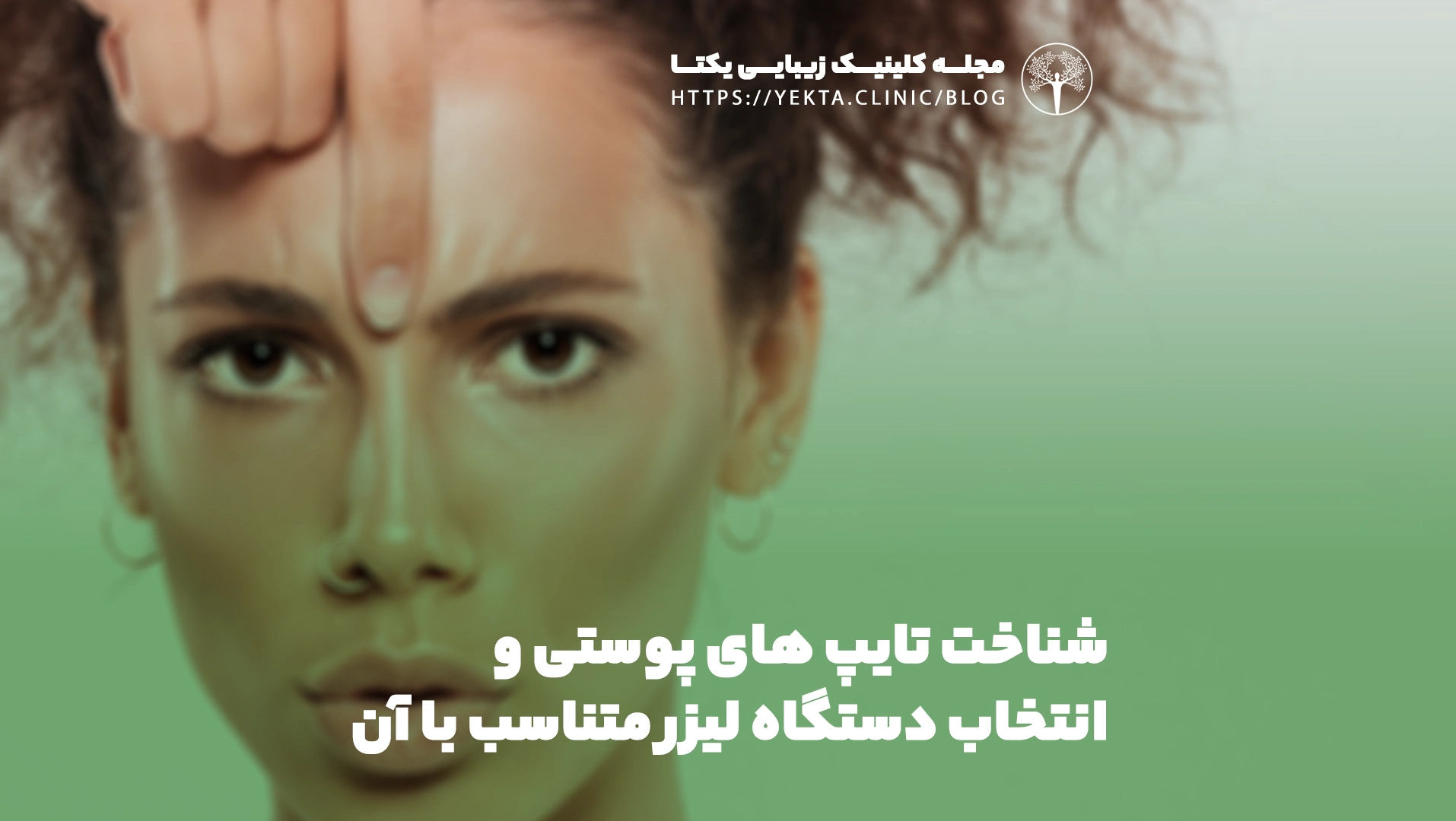 تایپ پوستی فیتزپاتریک چیست؟ 1 تایپ پوستی فیتزپاتریک و انتخاب لیزر در کلینیک یکتا