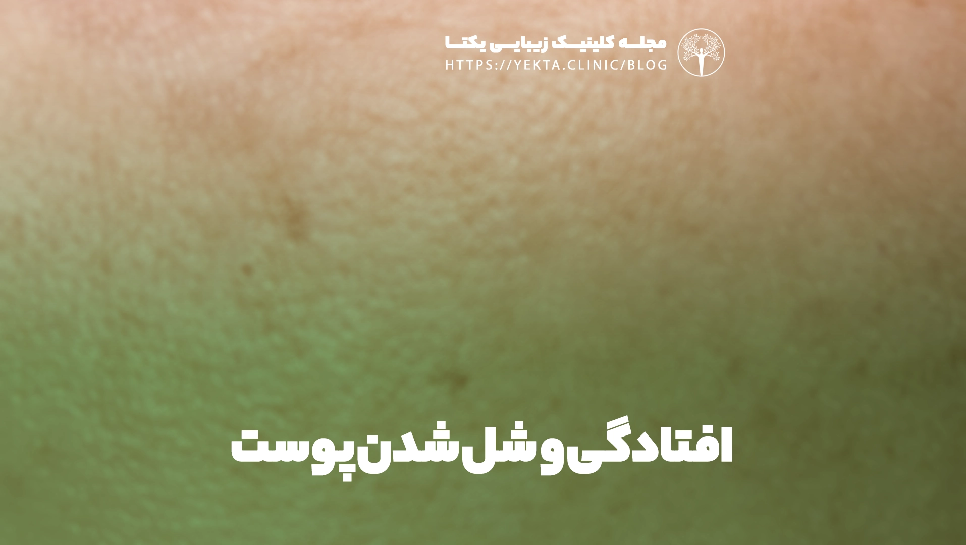 افتادگی و شل شدن پوست