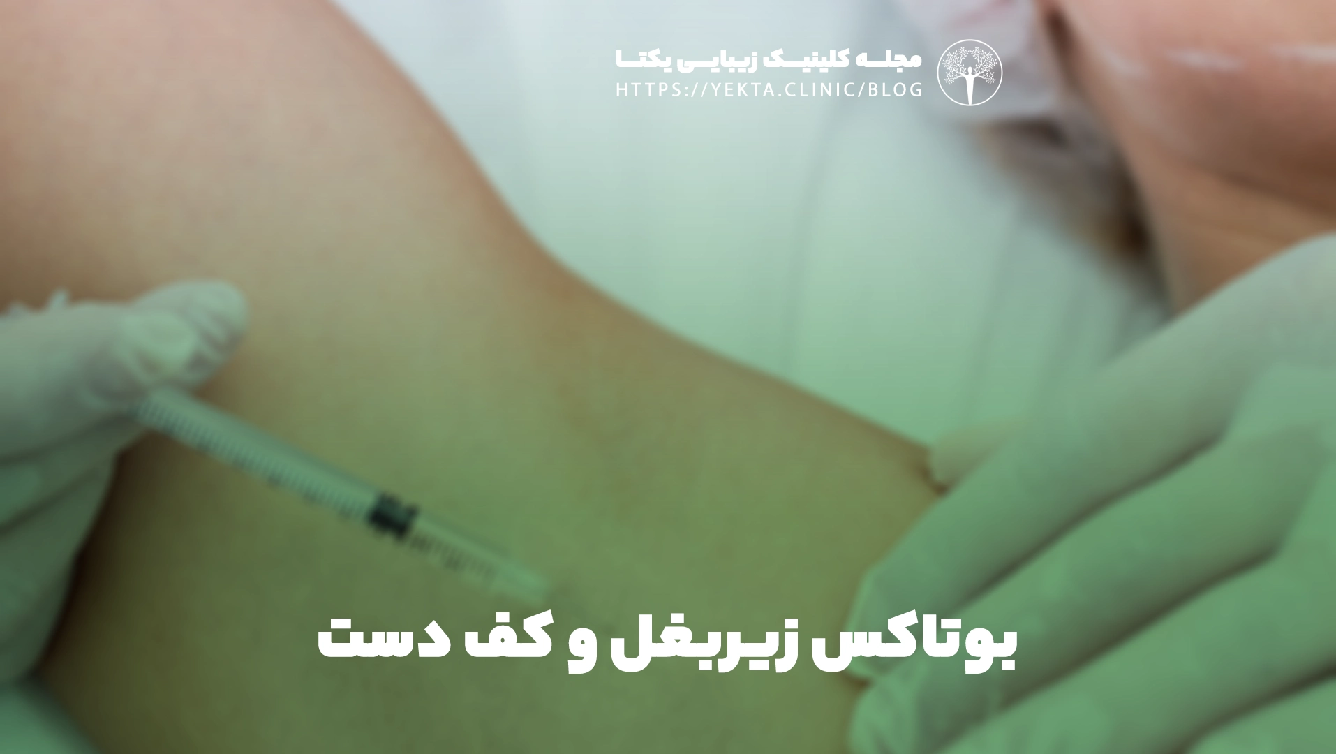 بوتاکس زیربغل و کف دست