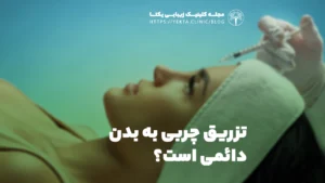 تزریق چربی به بدن دائمی است؟