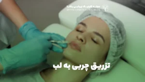 تزریق چربی به لب