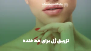 تزریق ژل برای خط خنده