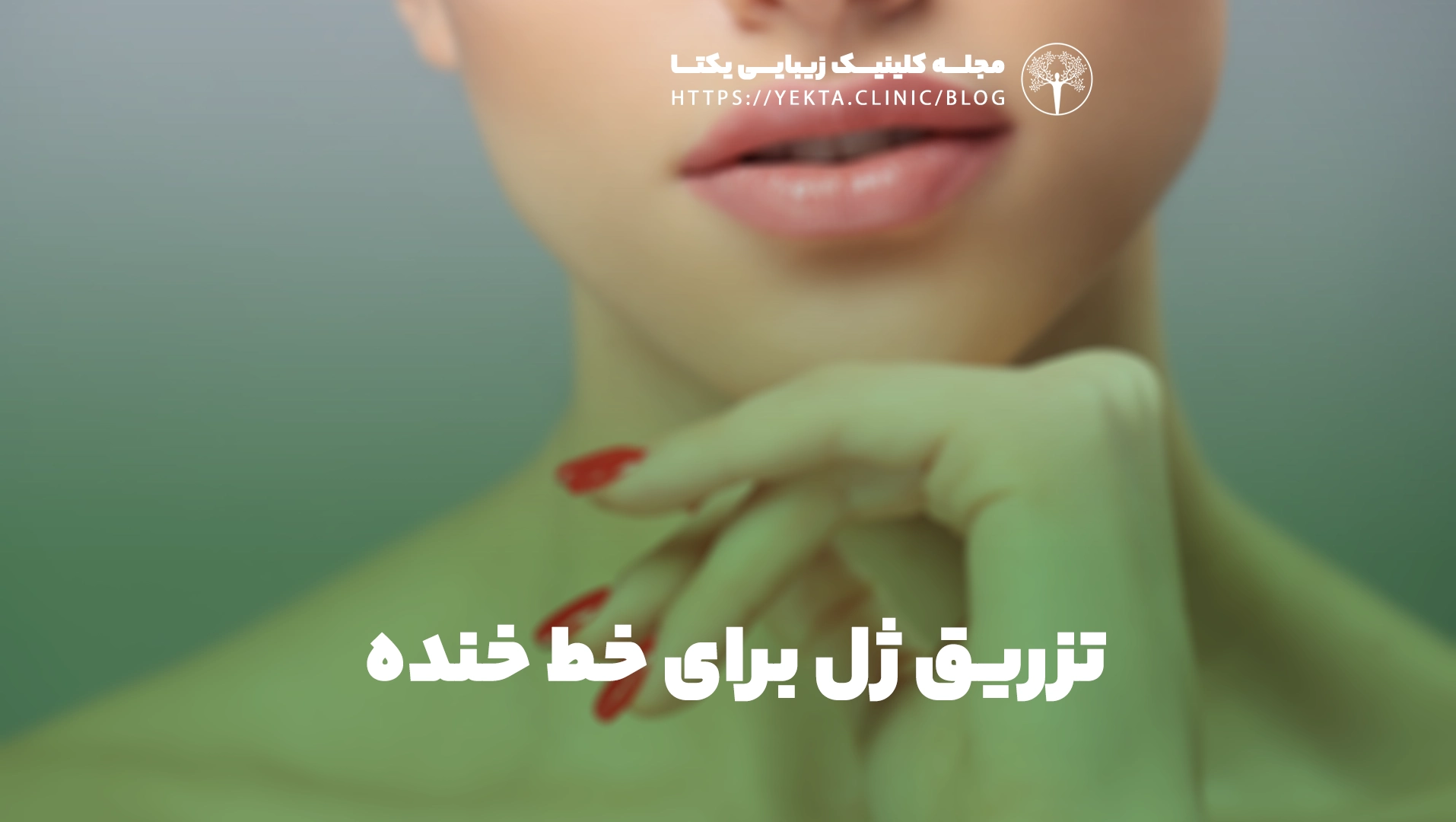تزریق ژل برای خط خنده