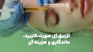 تزریق ژل صورت، کاربرد، ماندگاری و هزینه آن