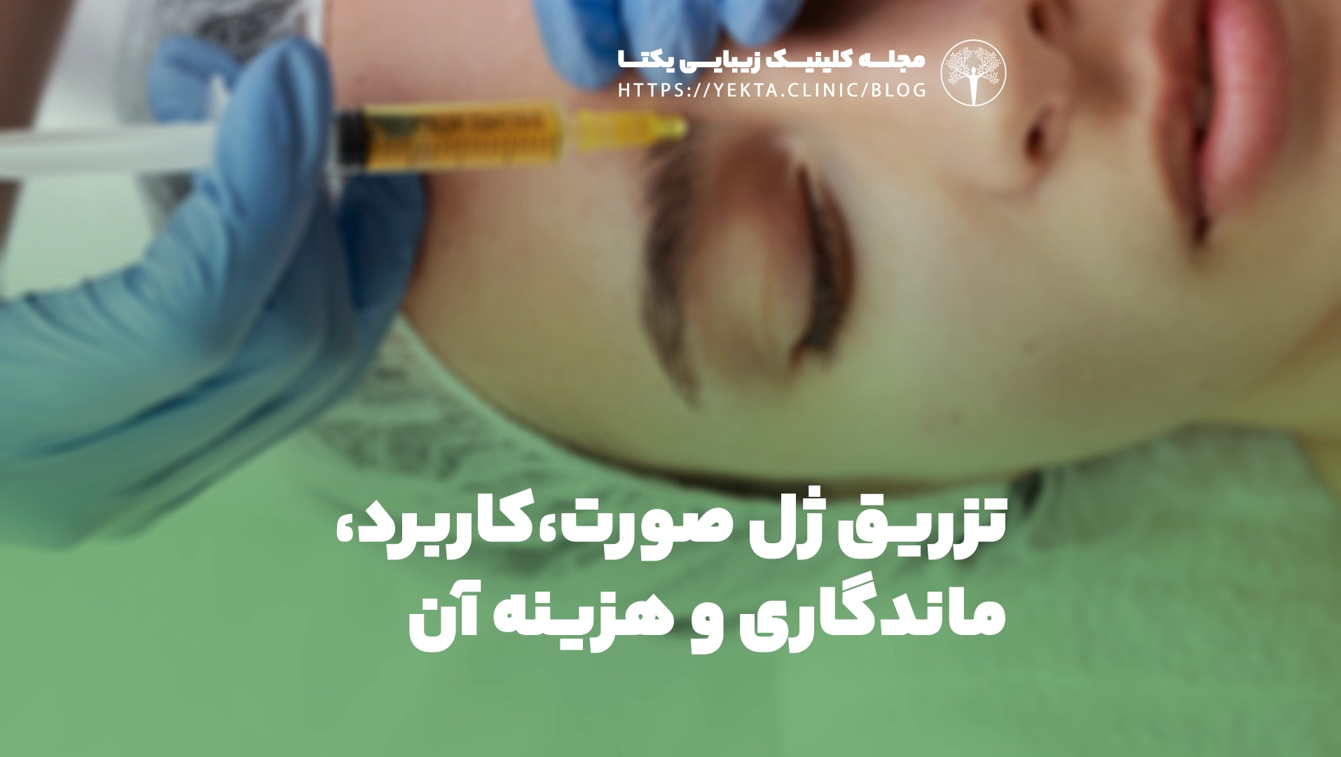تزریق ژل صورت، کاربرد، ماندگاری و هزینه آن