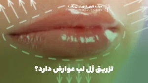 تزریق ژل لب عوارض دارد؟