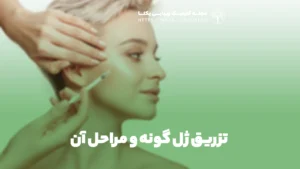 تزریق ژل گونه و مراحل آن