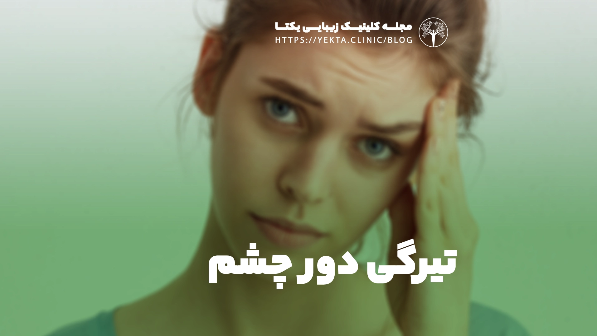تیرگی دور چشم