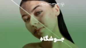 جوشگاه