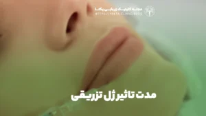 مدت تاثیر ژل تزریقی