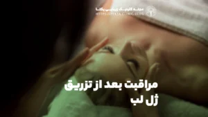 مراقبت بعد از تزریق ژل لب