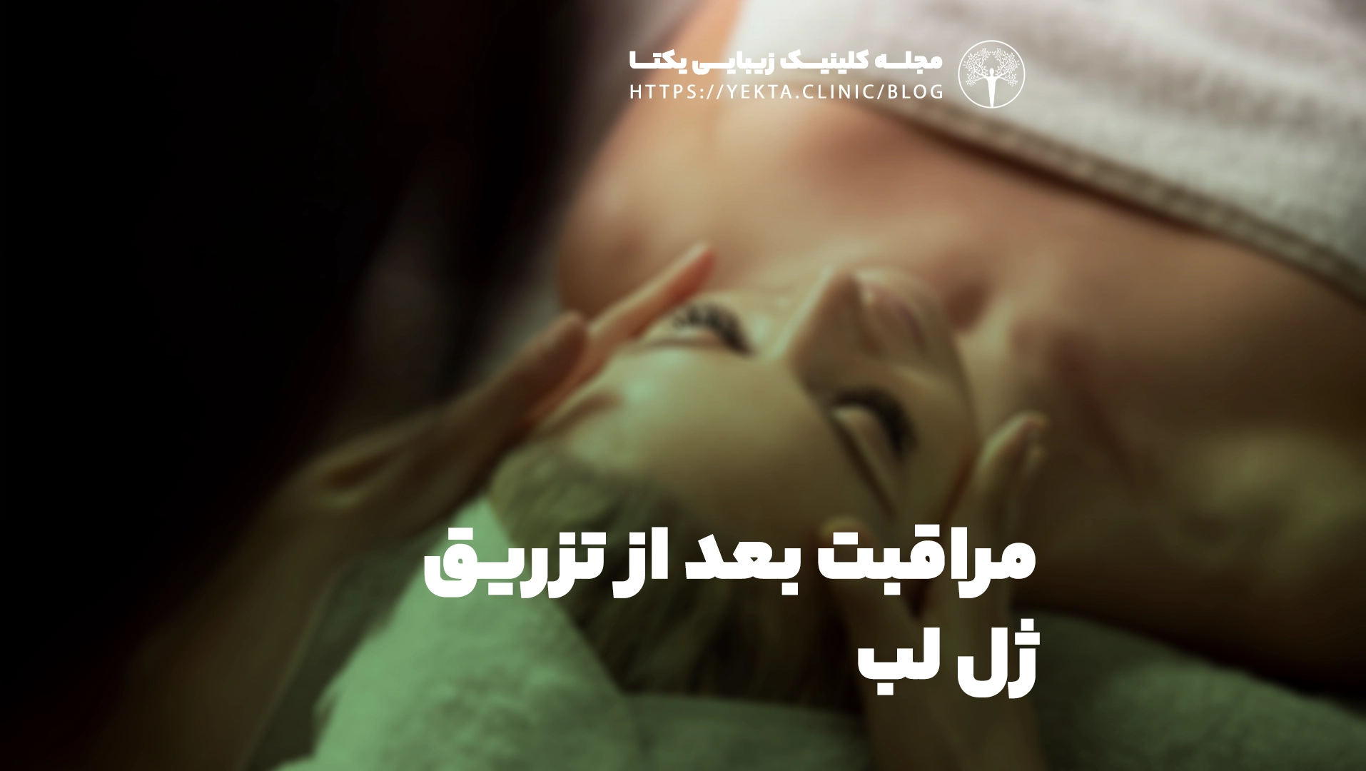 مراقبت بعد از تزریق ژل لب