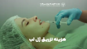 هزینه تزریق ژل لب