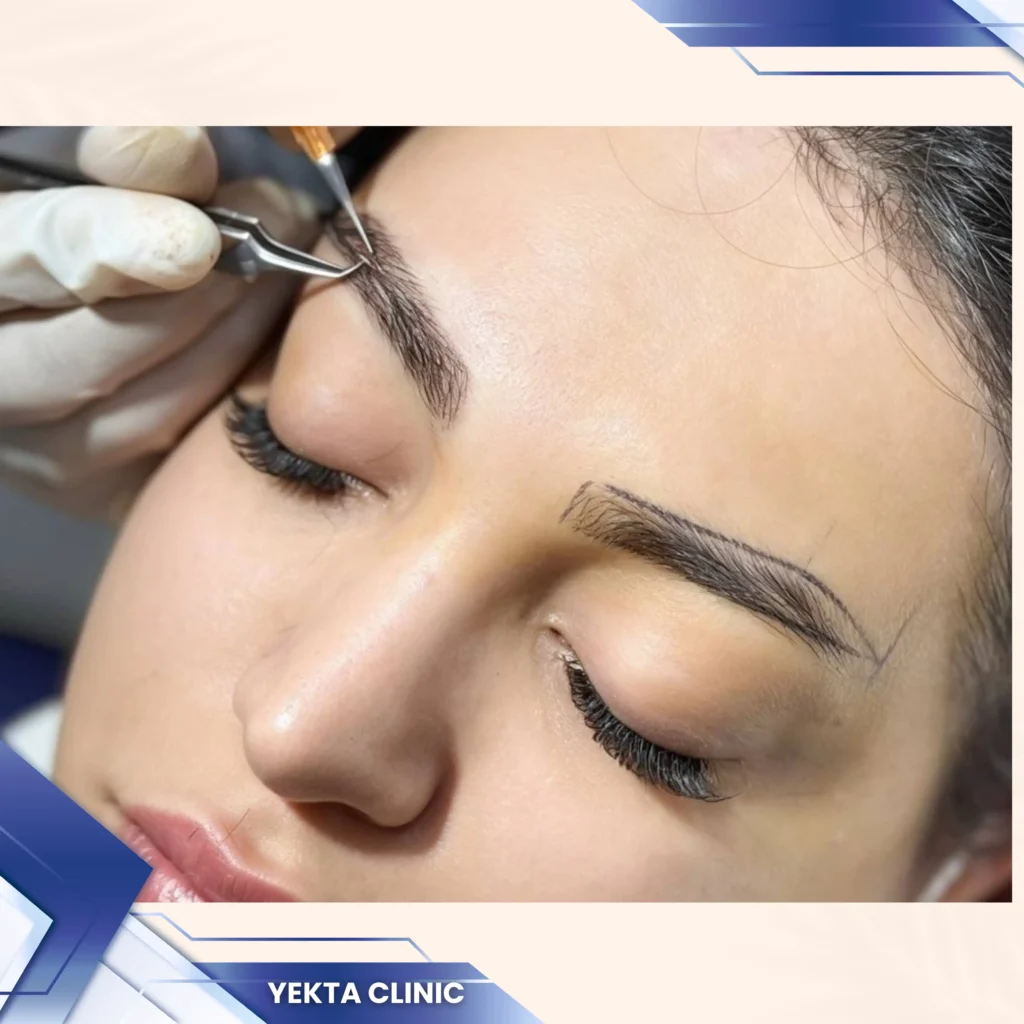 کاشت ابرو، کاشت ابرو پیروزی، کاشت ابرو طبیعی،